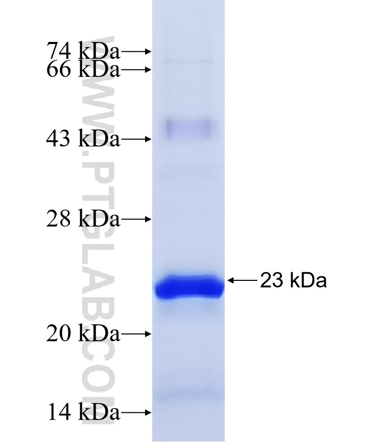KCNH2 fusion protein Ag14836 SDS-PAGE KCNH2 fusion protein Ag14836 SDS-PAGE