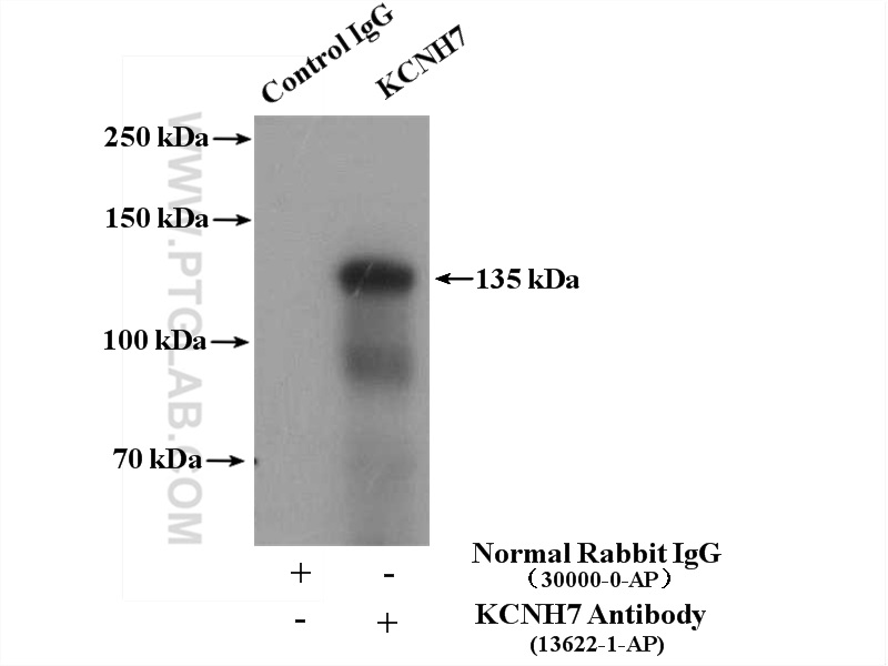 IP experiment of mouse brain using 13622-1-AP