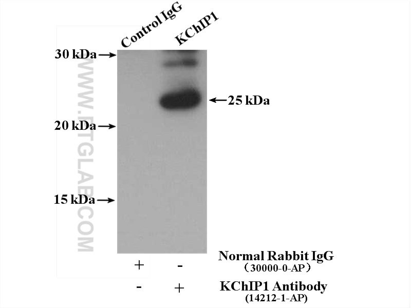 IP experiment of fetal human brain using 14212-1-AP (same clone as 14212-1-PBS)