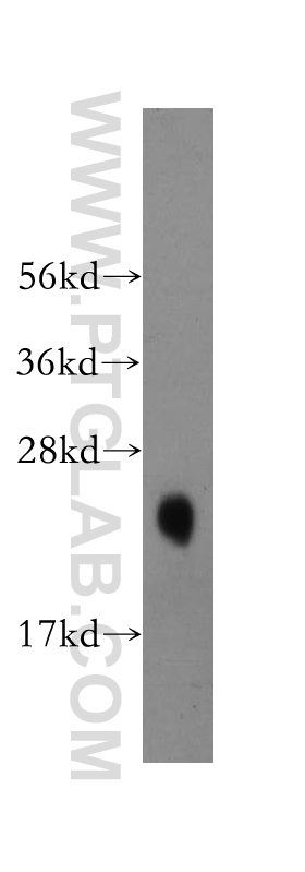 WB analysis of human cerebellum using 14212-1-AP (same clone as 14212-1-PBS)