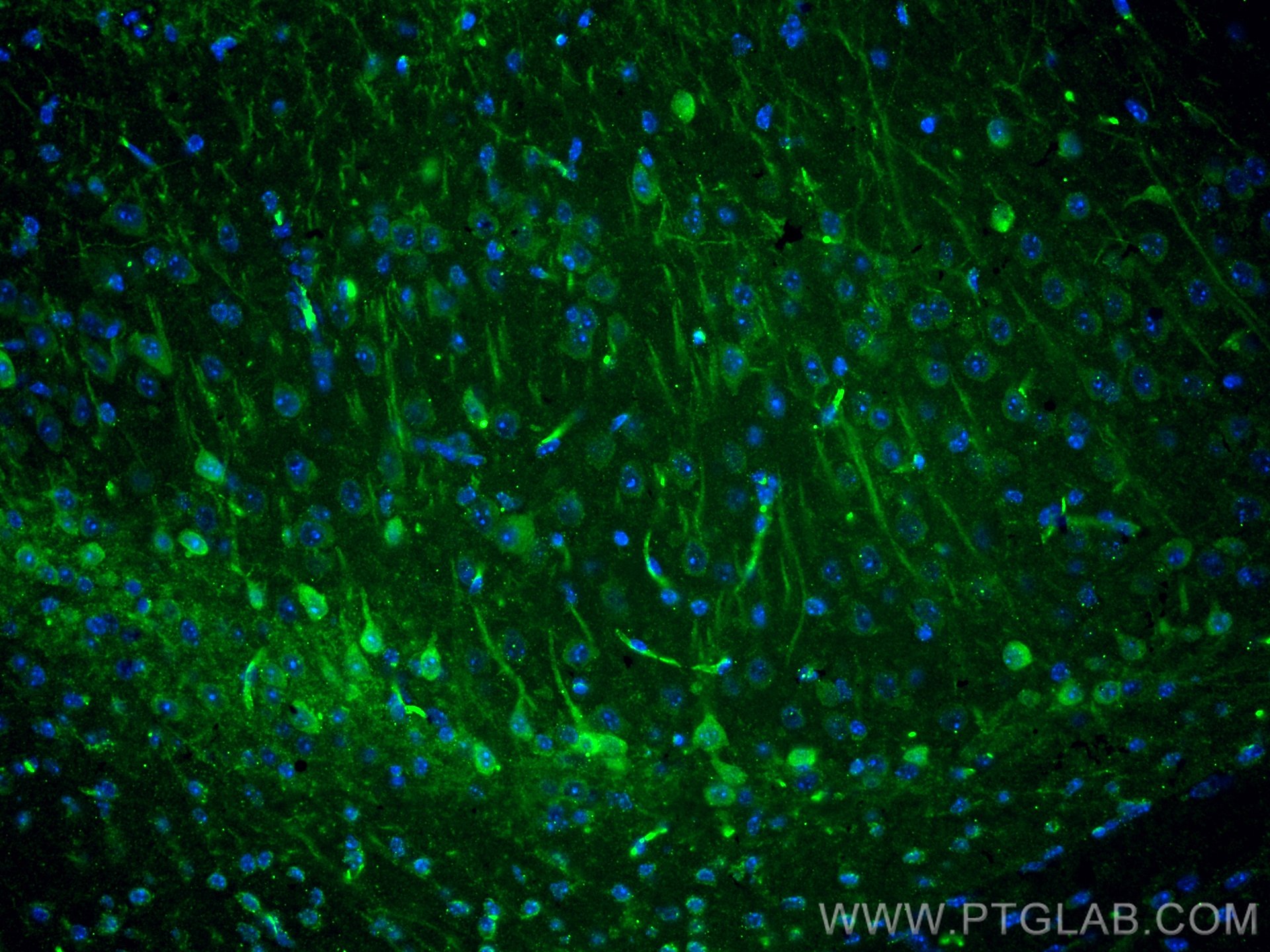 IF Staining of mouse brain using 66439-1-Ig (same clone as 66439-1-PBS)