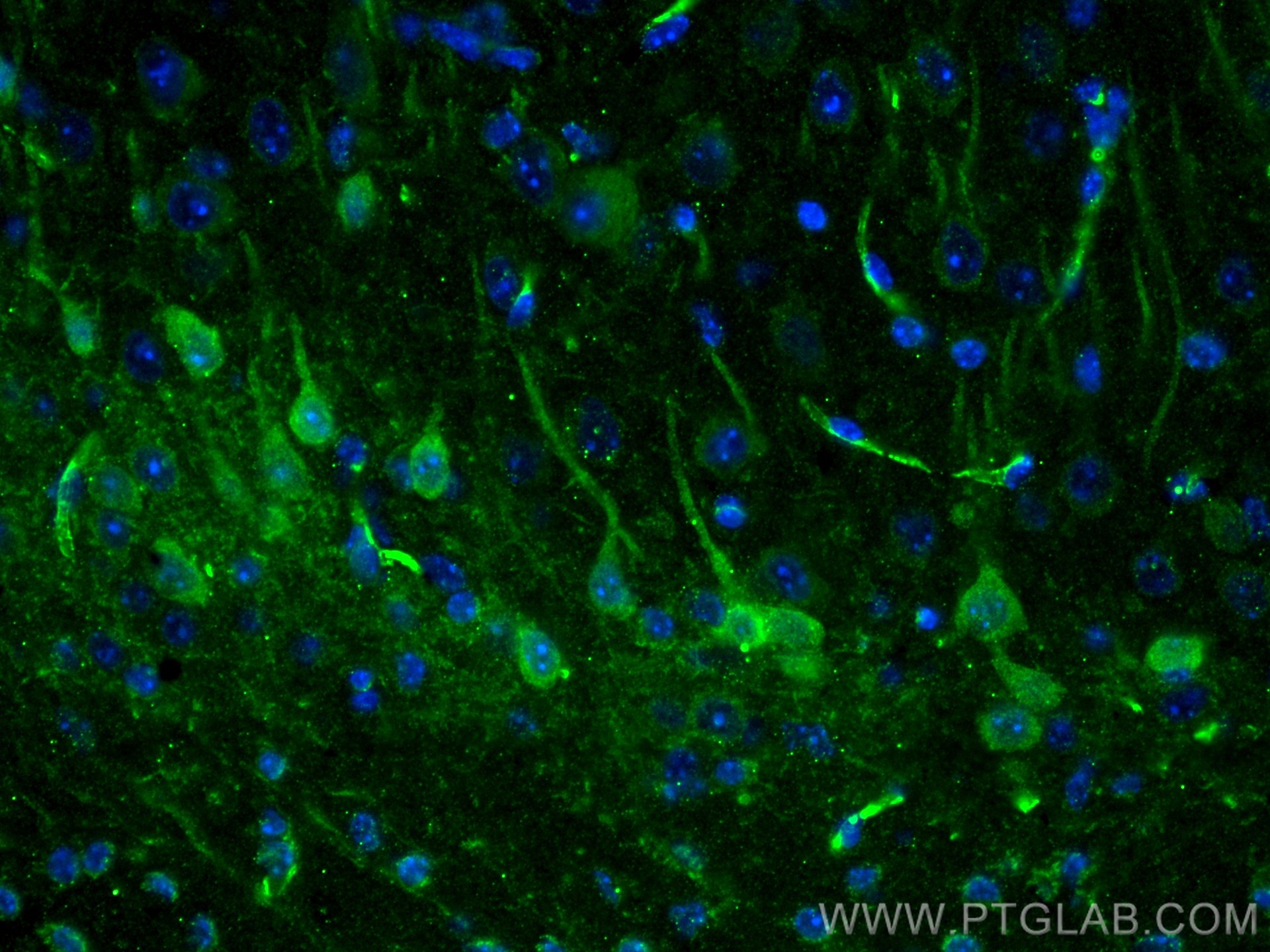 IF Staining of mouse brain using 66439-1-Ig (same clone as 66439-1-PBS)