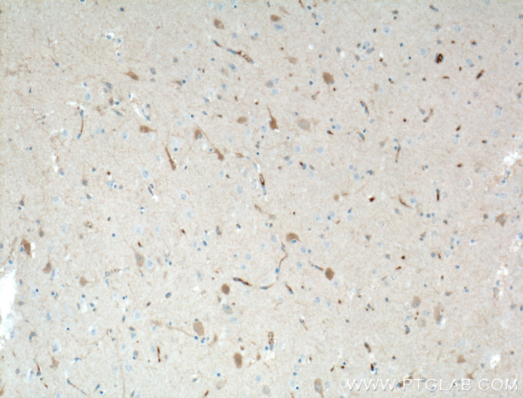 IHC staining of human brain using 66439-1-Ig (same clone as 66439-1-PBS)