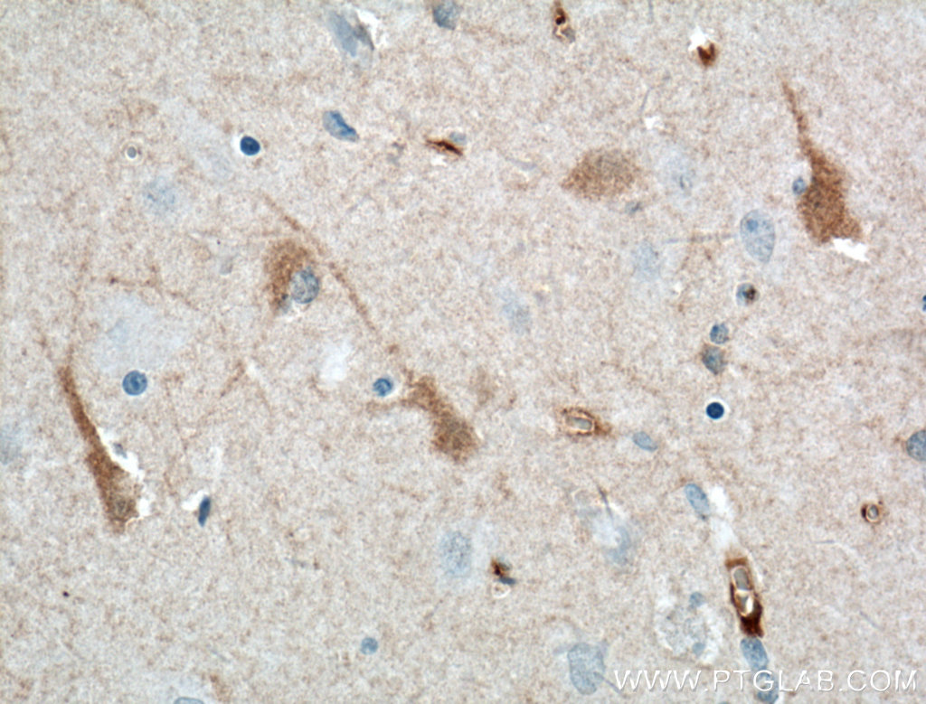 IHC staining of human brain using 66439-1-Ig (same clone as 66439-1-PBS)