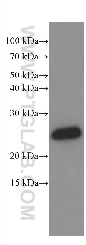WB analysis of human cerebellum using 66439-1-Ig (same clone as 66439-1-PBS)