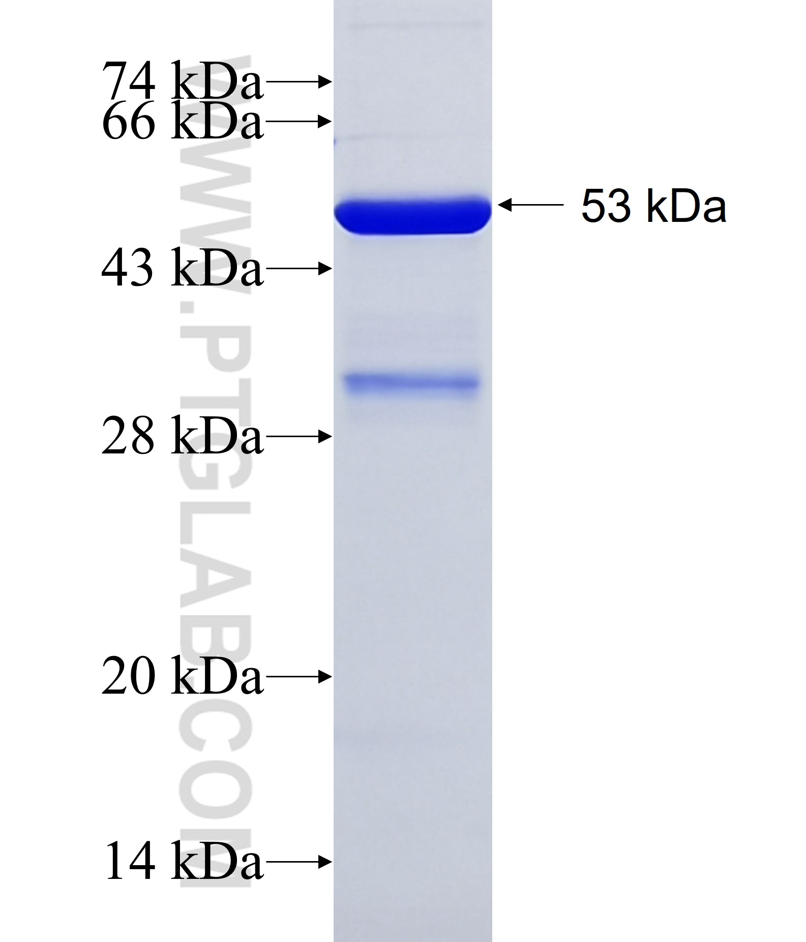 KCNIP3 fusion protein Ag2665 SDS-PAGE