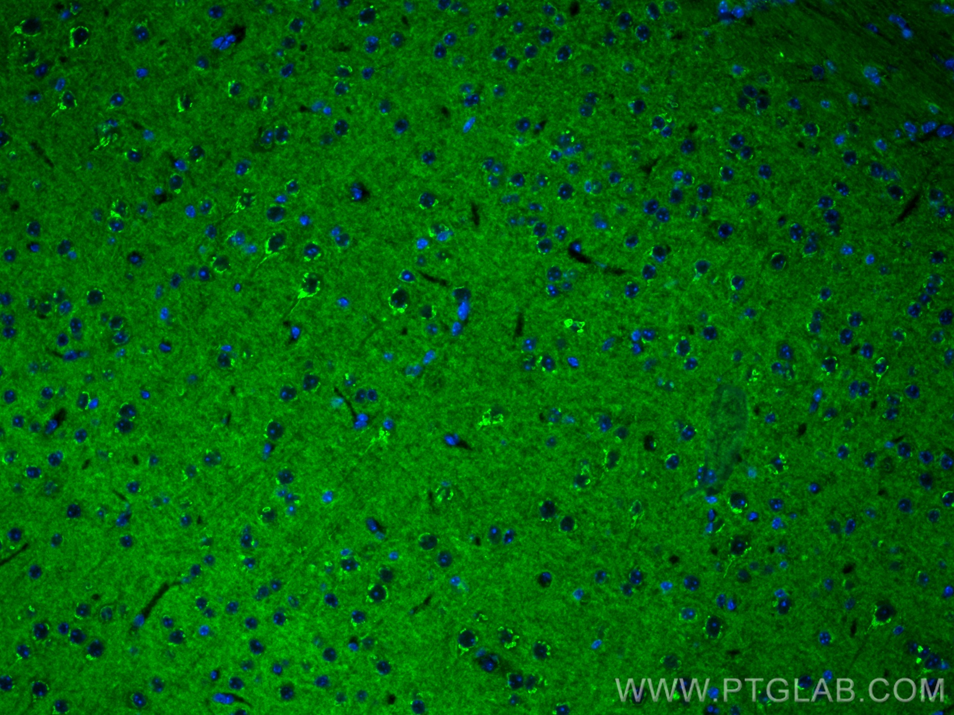 IF Staining of mouse brain using 60133-1-Ig