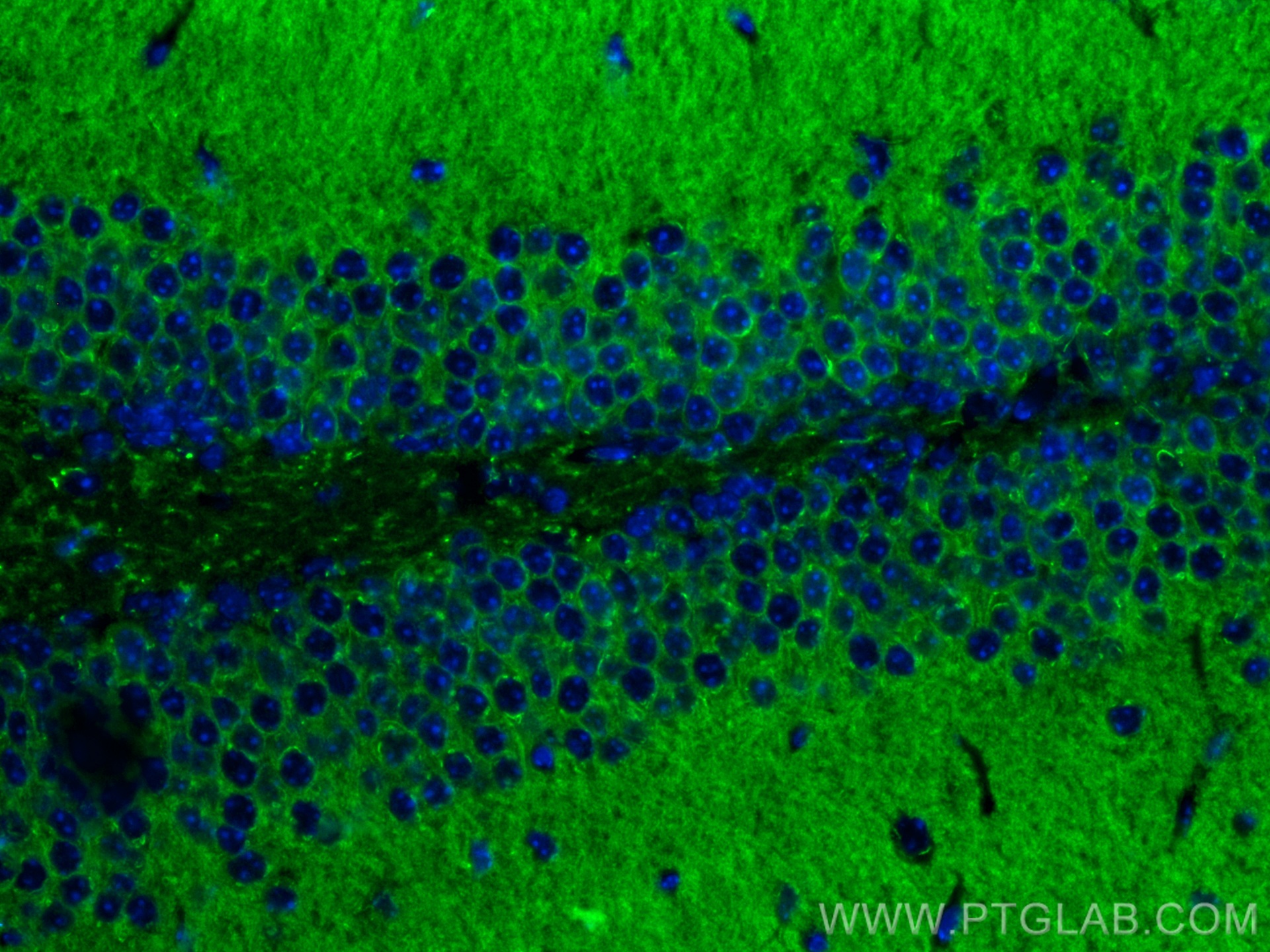 IF Staining of mouse brain using 60133-1-Ig
