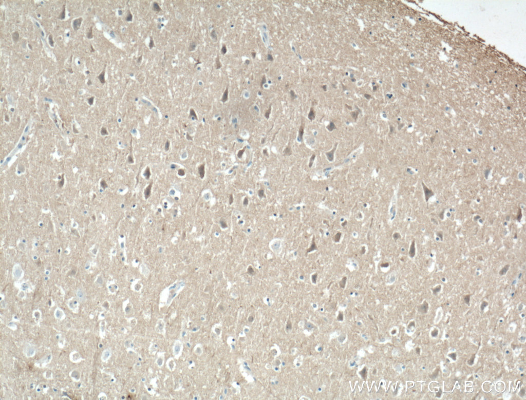 IHC staining of human brain using 60133-1-Ig