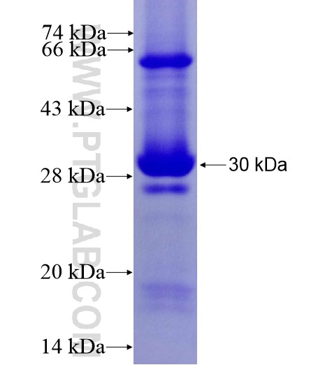Kir6.2 fusion protein Ag10368 SDS-PAGE Kir6.2 fusion protein Ag10368 SDS-PAGE