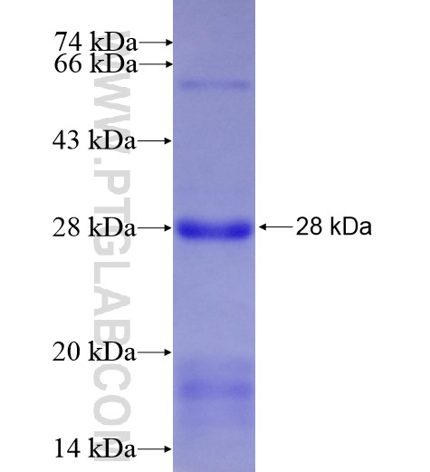 KCNJ13 fusion protein Ag8295 SDS-PAGE KCNJ13 fusion protein Ag8295 SDS-PAGE