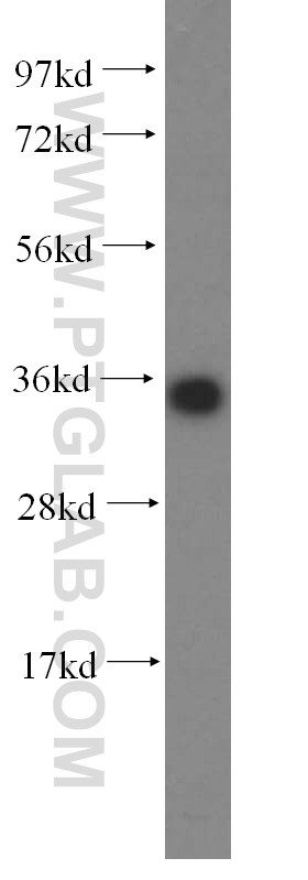 WB analysis of HeLa using 15988-1-AP