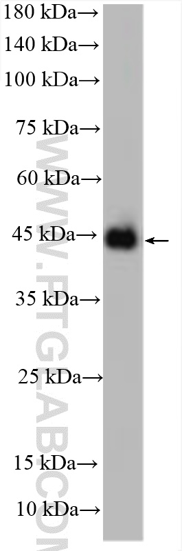 WB analysis of mouse skin using 30911-1-AP