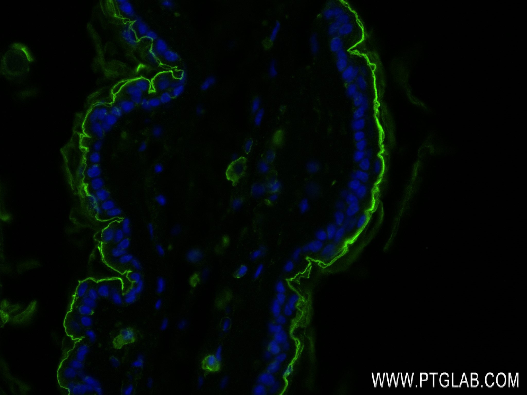 IF Staining of mouse skin using 84203-5-RR