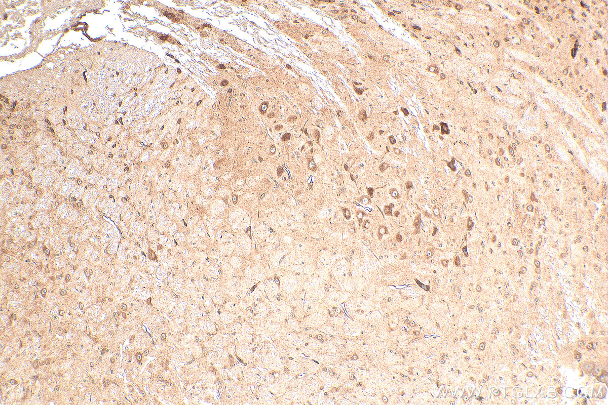 IHC staining of mouse cerebellum using 16985-1-AP