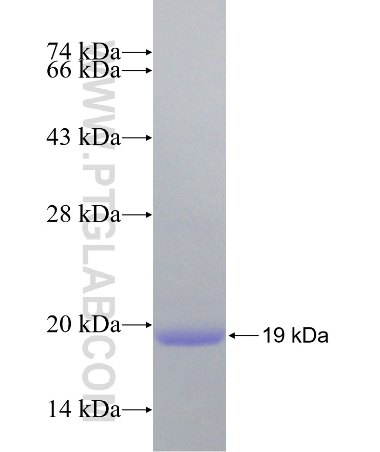KCNJ6 fusion protein Ag18072 SDS-PAGE