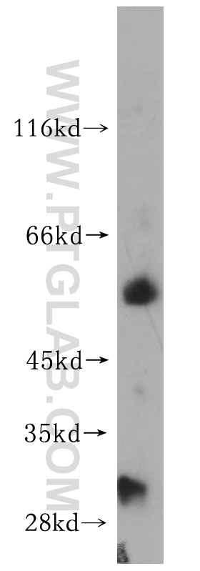 Kir6.1 Polyclonal antibody