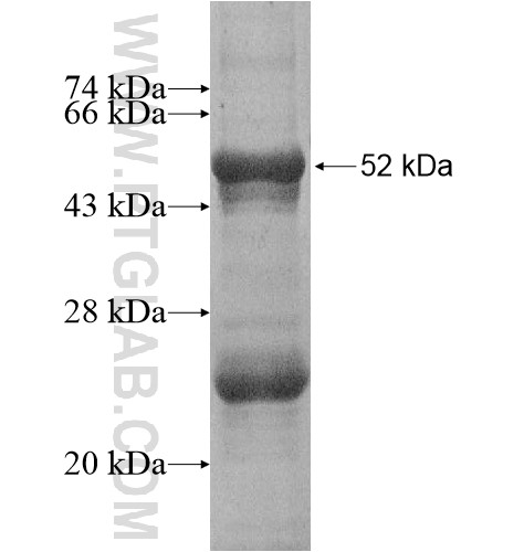 KCNJ8 fusion protein Ag6792 SDS-PAGE