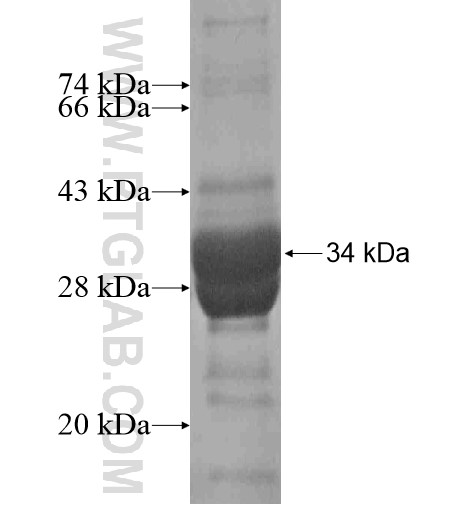 KCNK16 fusion protein Ag16096 SDS-PAGE KCNK16 fusion protein Ag16096 SDS-PAGE