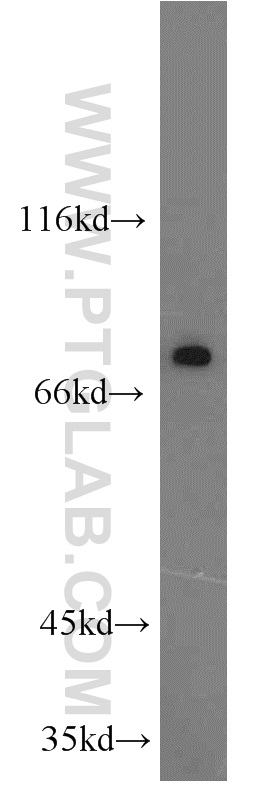 WB analysis of PC-3 using 14136-1-AP