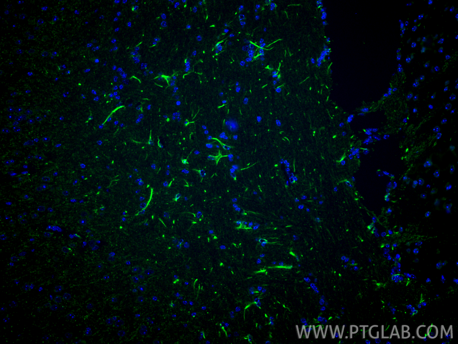 Immunofluorescent analysis of (4% PFA) fixed paraffin-embedded mouse brain tissue using KCNMA1 antibody (22158-1-AP) at dilution of 1:200 and CoraLite®488-Conjugated Goat Anti-Rabbit IgG(H+L) (<a class='green' href='/productredirect?CatalogNo=SA00013-2' target='_blank'>SA00013-2</a>). Heat mediated antigen retrieval with Tris-EDTA buffer (pH 9.0). IF Staining of mouse brain using 22158-1-AP