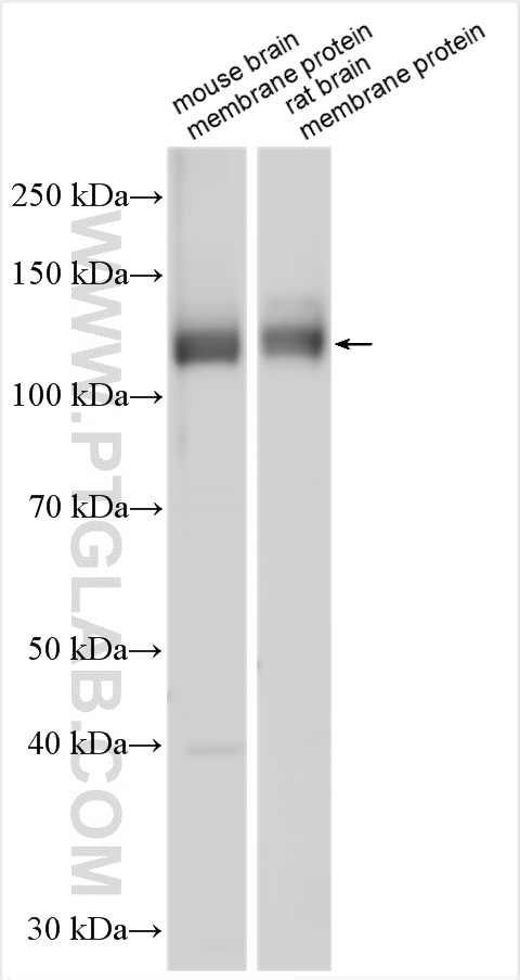 WB analysis using 22158-1-AP