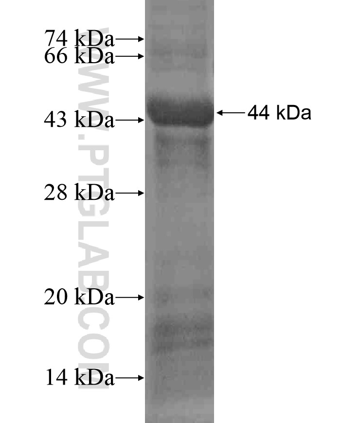KCNMA1 fusion protein Ag17883 SDS-PAGE KCNMA1 fusion protein Ag17883 SDS-PAGE