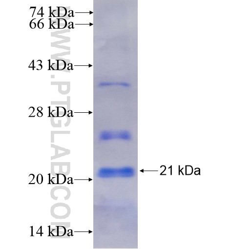KCNMB1 fusion protein Ag16025 SDS-PAGE KCNMB1 fusion protein Ag16025 SDS-PAGE