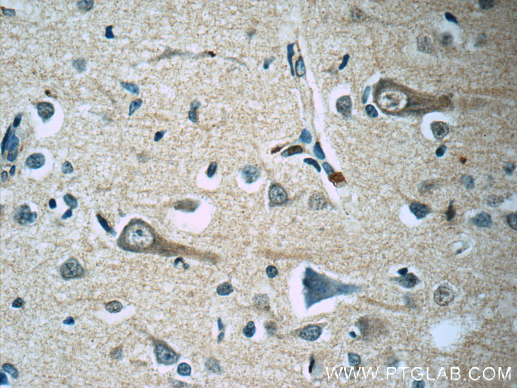 IHC staining of human brain using 60122-1-Ig (same clone as 60122-1-PBS)
