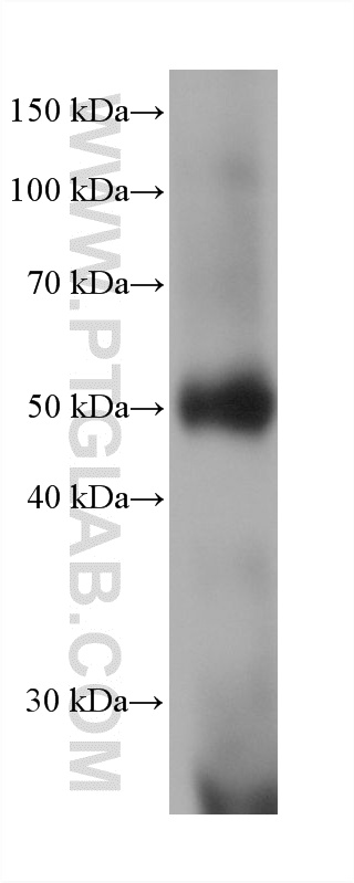 WB analysis of human blood using 60276-1-Ig WB analysis of human blood using 60276-1-Ig