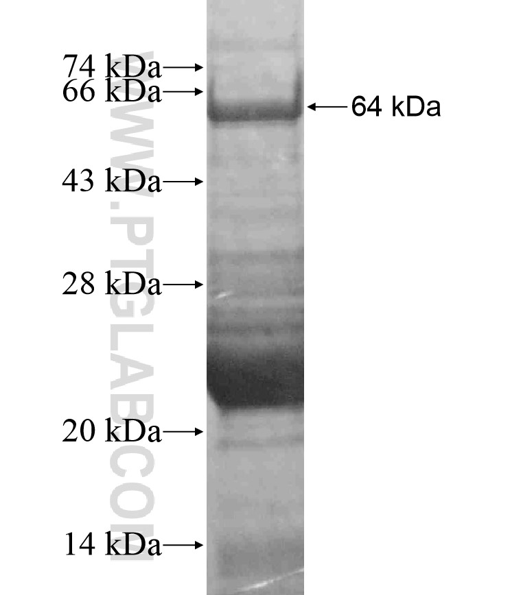KCNQ1 fusion protein Ag17951 SDS-PAGE KCNQ1 fusion protein Ag17951 SDS-PAGE