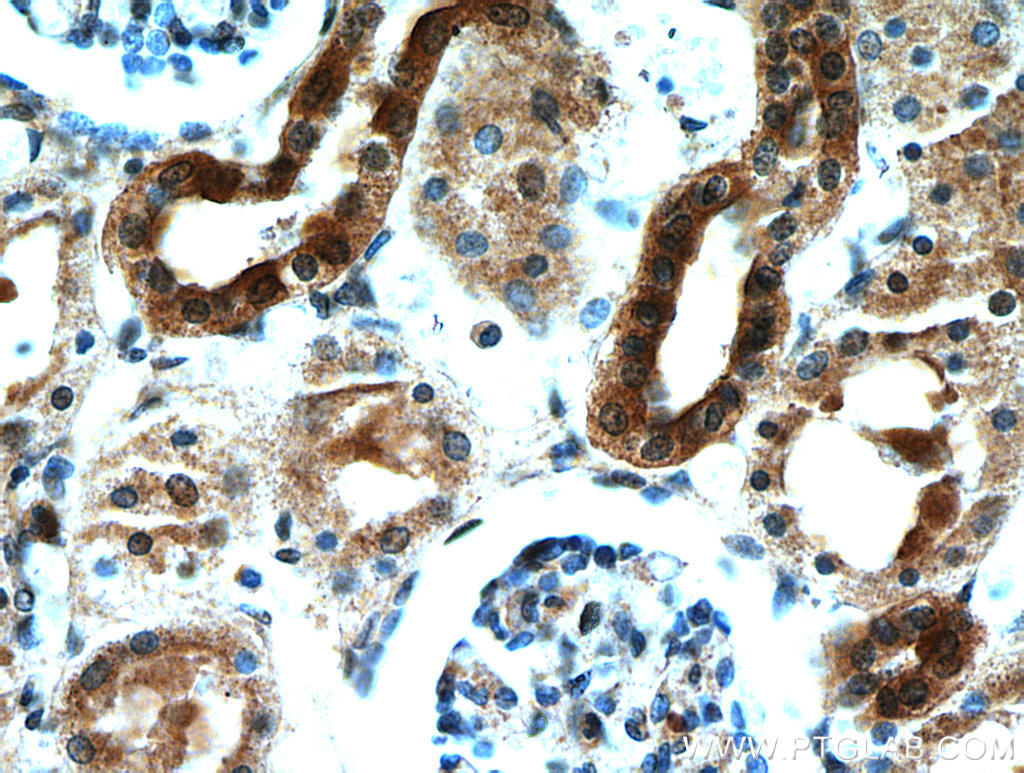 IHC staining of human kidney using 21233-1-AP