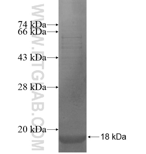 KCNQ2 fusion protein Ag14036 SDS-PAGE KCNQ2 fusion protein Ag14036 SDS-PAGE