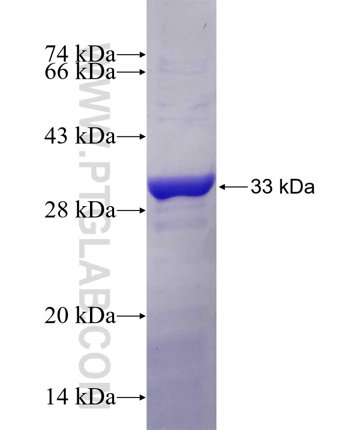 KCNRG fusion protein Ag4347 SDS-PAGE KCNRG fusion protein Ag4347 SDS-PAGE