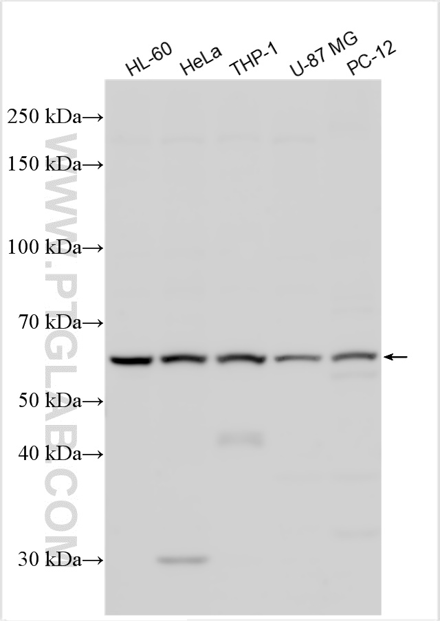 WB analysis using 29988-1-AP