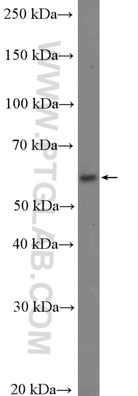 KCNS3