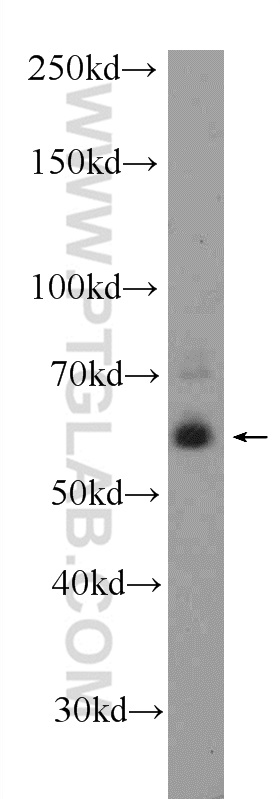 KCNV1