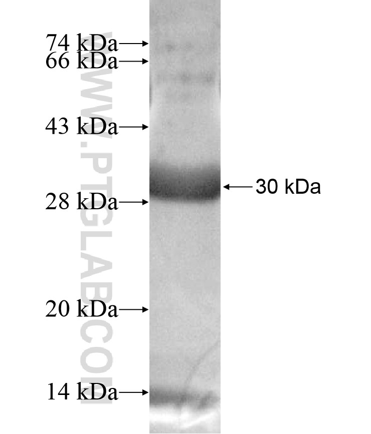 KCNV2 fusion protein Ag17020 SDS-PAGE KCNV2 fusion protein Ag17020 SDS-PAGE