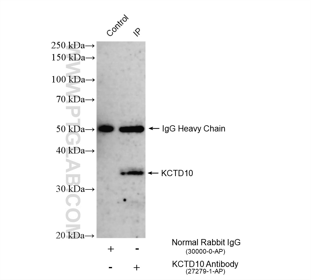 IP result of anti-KCTD10 (IP:27279-1-AP, 4ug; Detection:27279-1-AP 1:2000) with HuH-7 cells lysate 880 ug. IP experiment of HuH-7 using 27279-1-AP