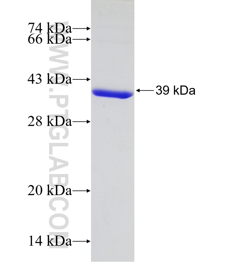 KCTD10 fusion protein Ag12235 SDS-PAGE KCTD10 fusion protein Ag12235 SDS-PAGE
