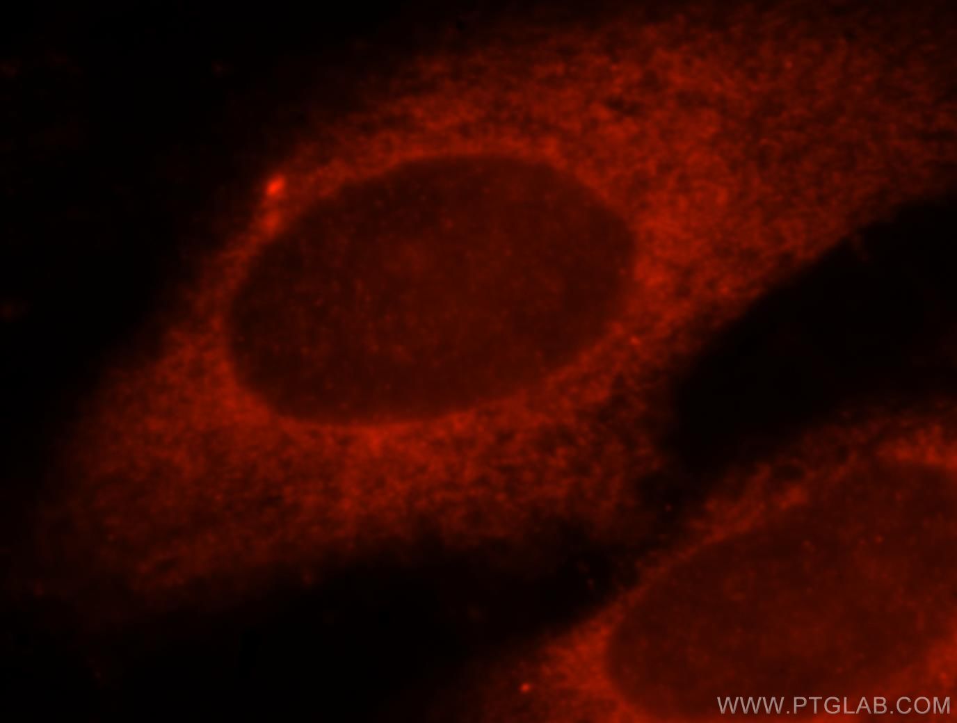 IF Staining of HeLa using 15523-1-AP