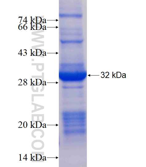 KCTD14 fusion protein Ag16969 SDS-PAGE KCTD14 fusion protein Ag16969 SDS-PAGE