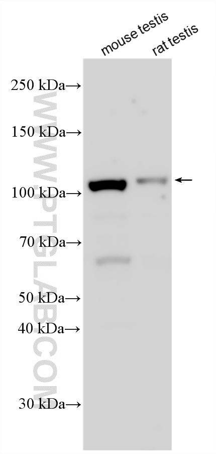 WB analysis using 33194-1-AP WB analysis using 33194-1-AP