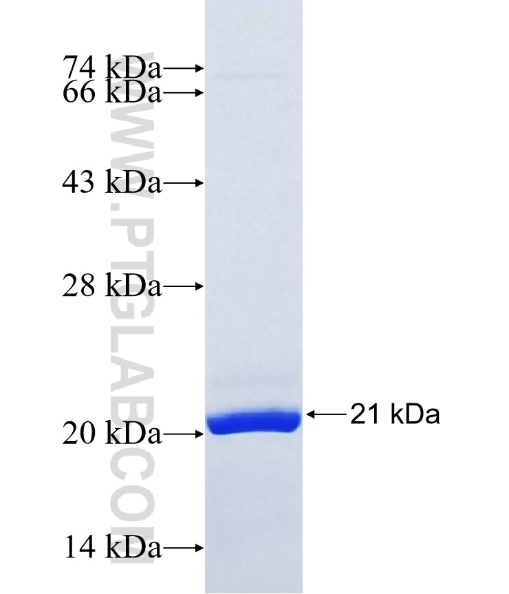 KCTD19 fusion protein Ag36697 SDS-PAGE KCTD19 fusion protein Ag36697 SDS-PAGE