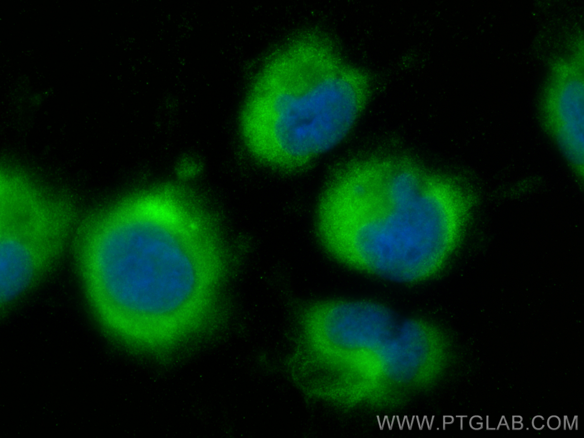 IF Staining of U-251 using 32728-1-AP IF Staining of U-251 using 32728-1-AP
