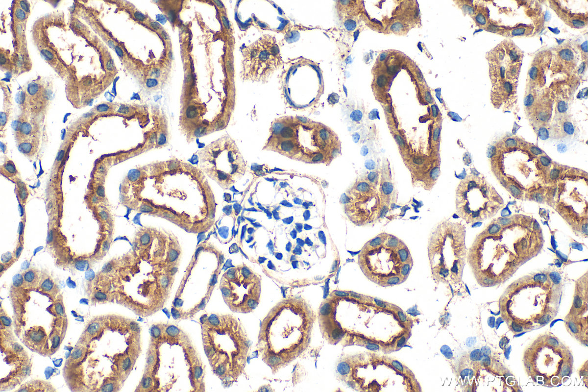 IHC staining of mouse kidney using 32728-1-AP IHC staining of mouse kidney using 32728-1-AP