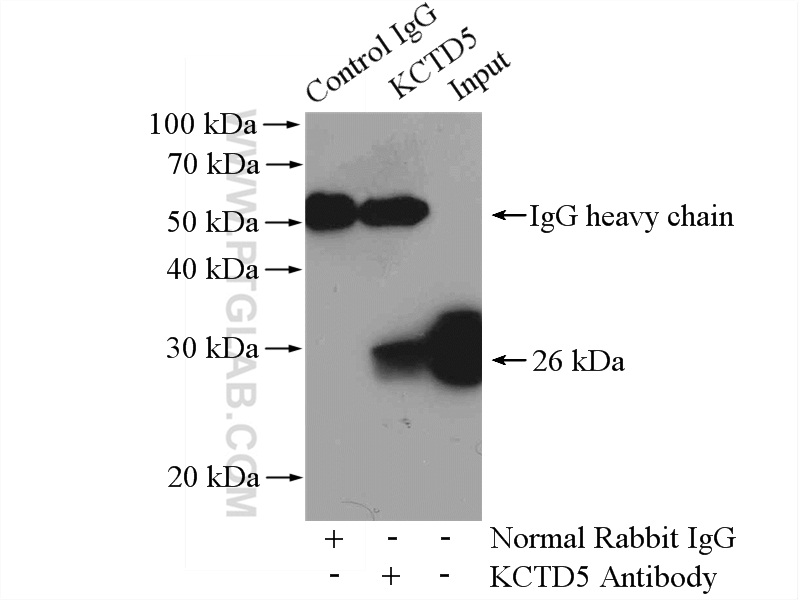 IP experiment of HeLa using 15553-1-AP