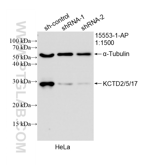 WB analysis of HeLa using 15553-1-AP WB analysis of HeLa using 15553-1-AP