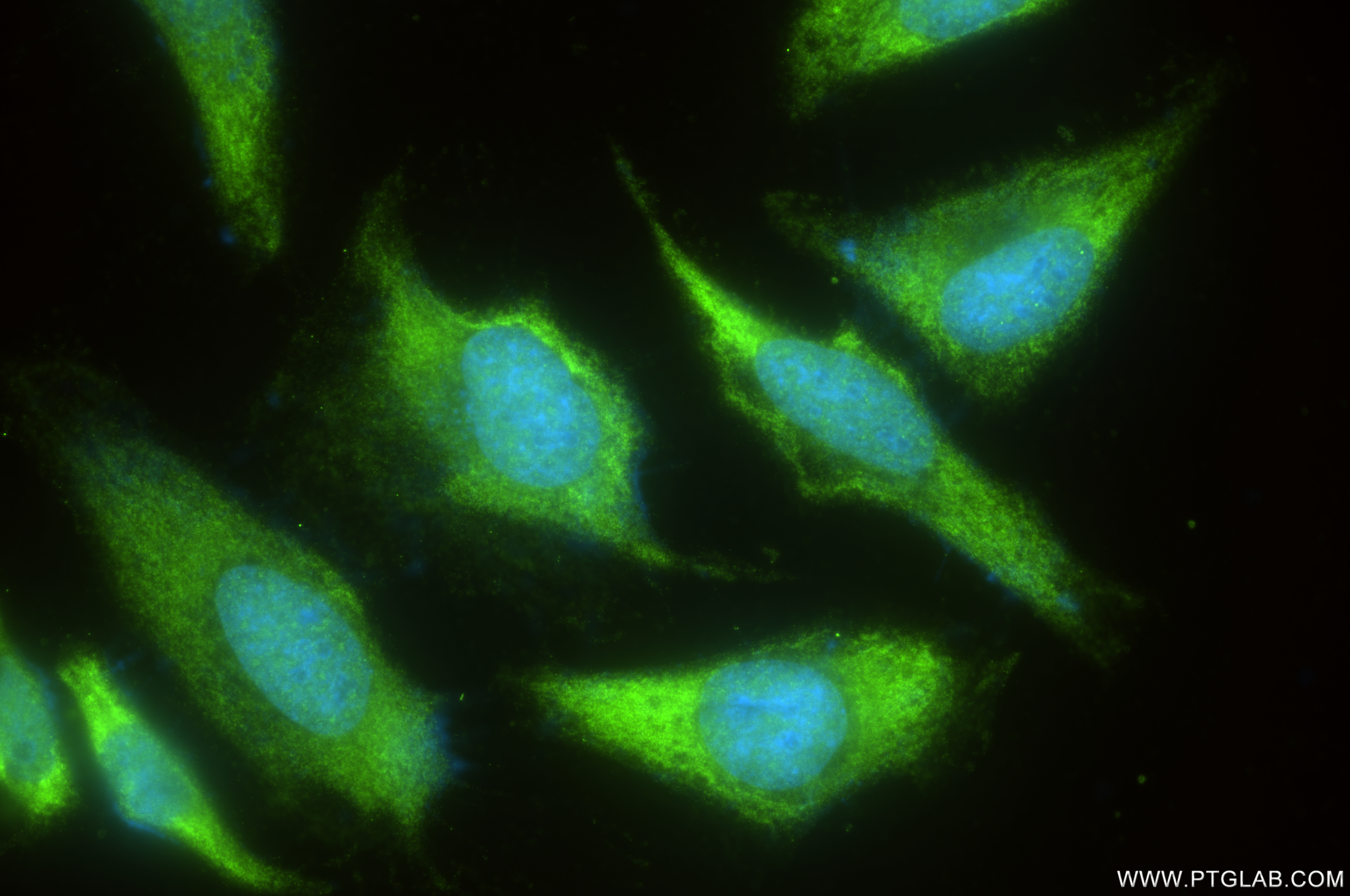 IF Staining of HeLa using 85210-4-RR (same clone as 85210-4-PBS)