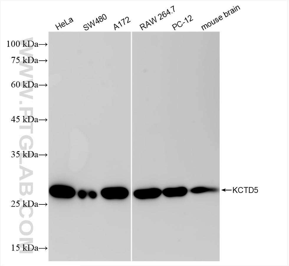WB analysis using 85210-5-RR (same clone as 85210-5-PBS)